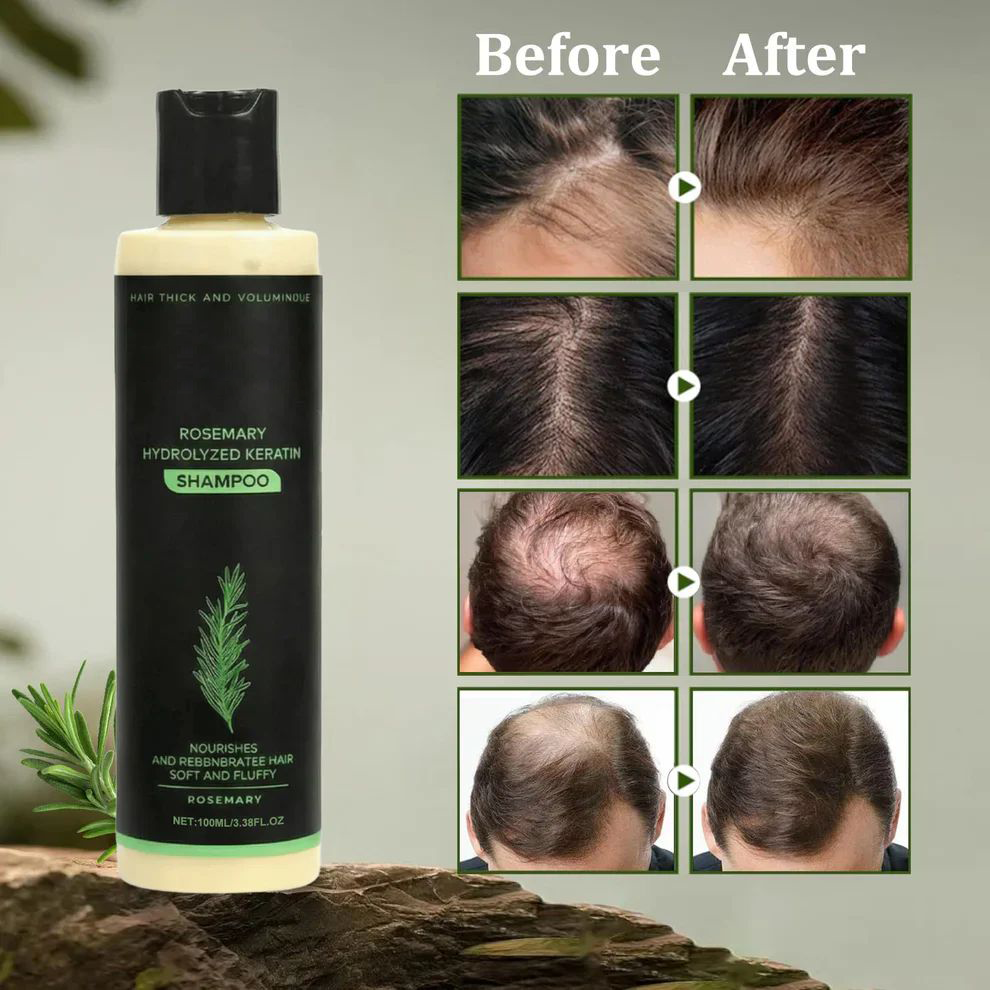 Buy 1 Get 1 Free(2PCS)